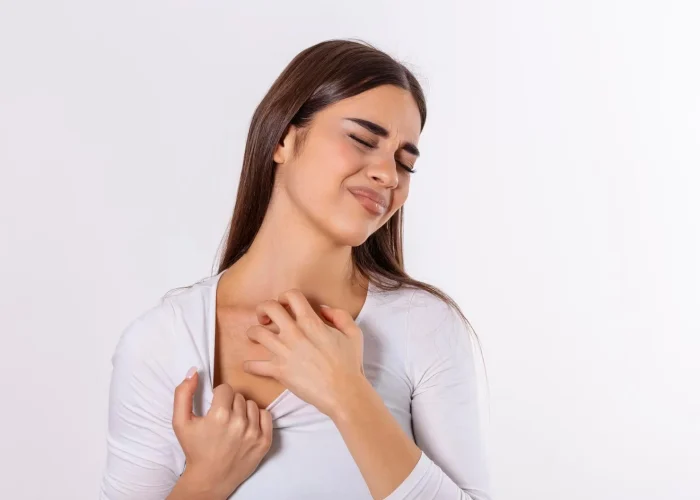 Pruritus